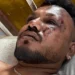 Hallan sobreviviente de accidente aéreo ocurrdio en India