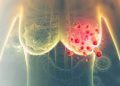 Revelan nuevo tratamiento contra el cáncer