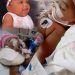 Madre clama por ayuda para suhija de un año afronta cáncer de colon